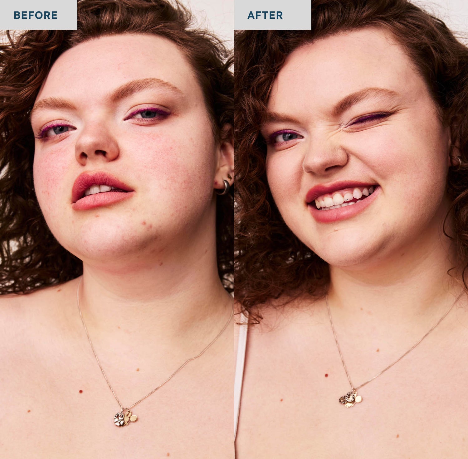 Two photos of a woman with curly brown hair on a white background and wearing a top with white spaghetti straps and a gold necklace. The lefthand photo is labeled "before" and she is not wearing concealer on her skin, which shows some blemishes. The righthand photo is labeled "after", and she is wearing SPATCH invisible powder spot fix, which covers her skin imperfections.
