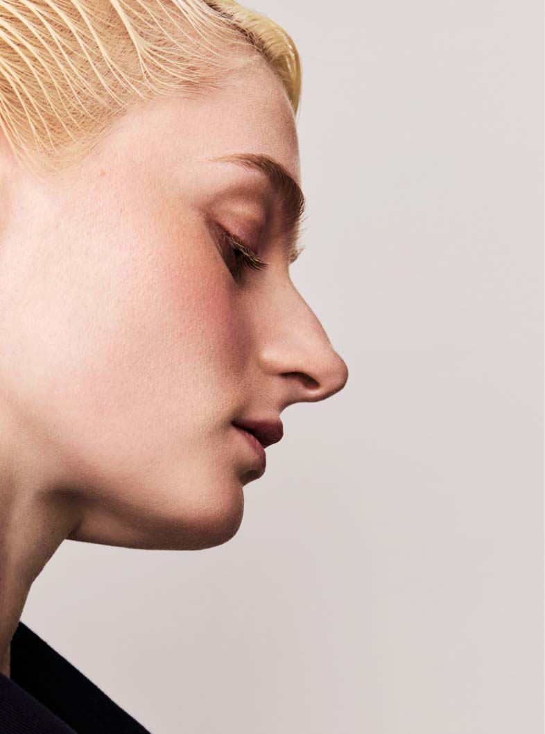 A blonde woman in profile on a gray background with areas of her face highlighted and labeled "bruises, dark spots, dark circles, rosacea, redness, and acne"