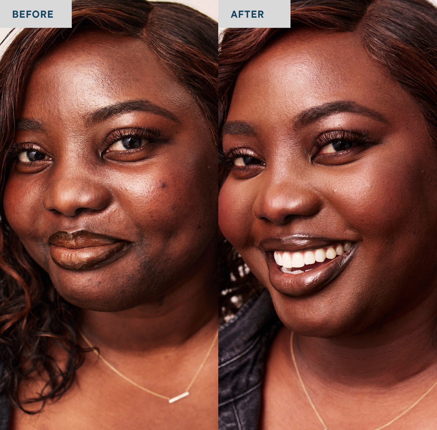 Two photos of a smiling woman looking at the camera, wearing a denim jacket and a gold necklace. The lefthand photo is labeled "before" and she is not wearing concealer on her skin, which shows some blemishes. The righthand photo is labeled "after", and she is wearing SPATCH invisible powder spot fix, which covers her skin imperfections. 